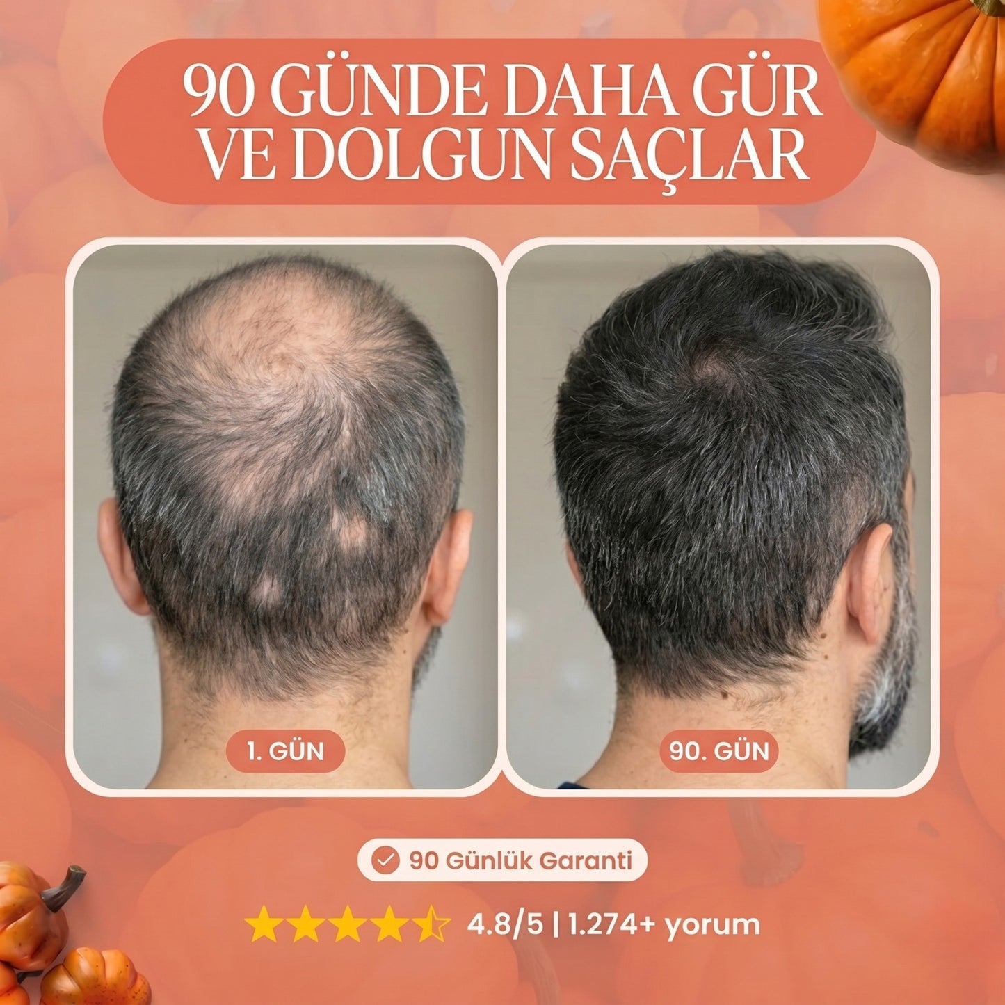 Kabak Çekirdeği Özü Yumuşak Kapsüller