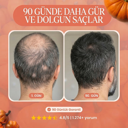 Kabak Çekirdeği Özü Yumuşak Kapsüller