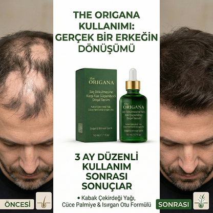 Saç Dökülmesini Durduran Ve Saçları Yenileyen Güçlü Doğal Serum