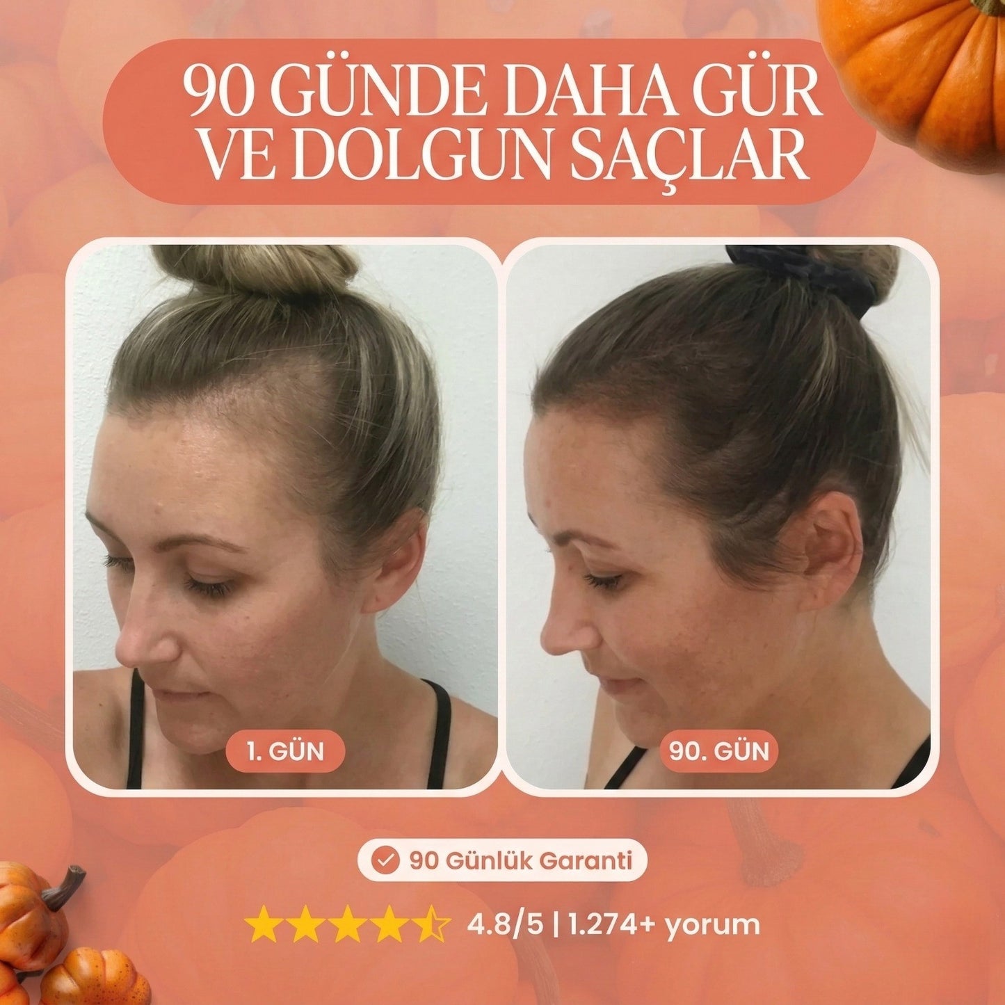 Kabak Çekirdeği Özü Yumuşak Kapsüller