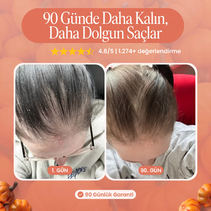 Dökülme karşıtı Kabak Çekirdeği Özü Yumuşak Kapsüller