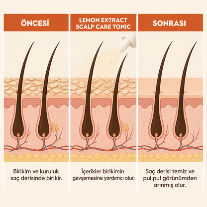 Kepek Karşıtı Lemon Extract Scalp Care Tonic