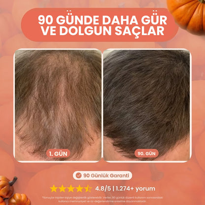 Dökülme Karşıtı Kabak Çekirdeği ve Saw Palmetto Özlü Şampuan