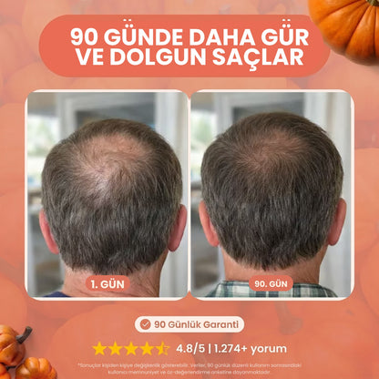 Dökülme Karşıtı Kabak Çekirdeği ve Saw Palmetto Özlü Şampuan