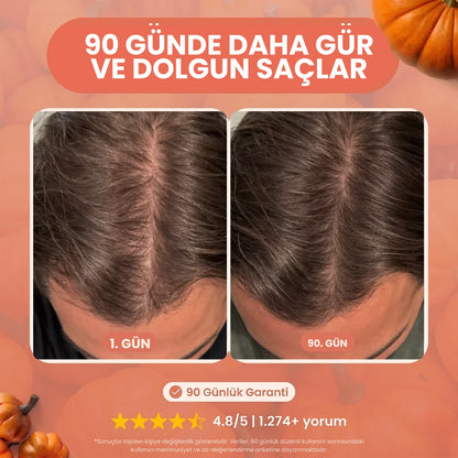 Dökülme Karşıtı Kabak Çekirdeği ve Saw Palmetto Özlü Şampuan