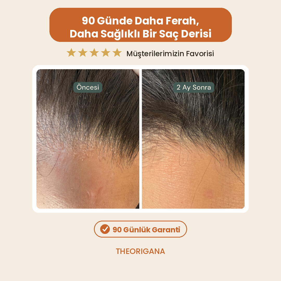 Kepek Karşıtı Lemon Extract Scalp Care Tonic