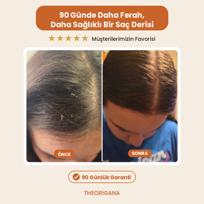 Kepek Karşıtı Lemon Extract Scalp Care Tonic