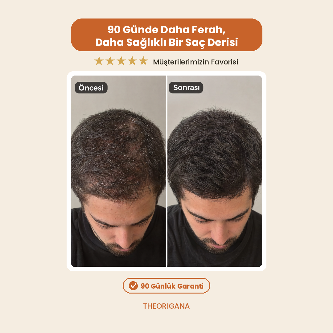 Kepek Karşıtı Lemon Extract Scalp Care Tonic