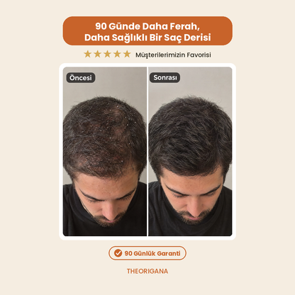 Kepek Karşıtı Lemon Extract Scalp Care Tonic